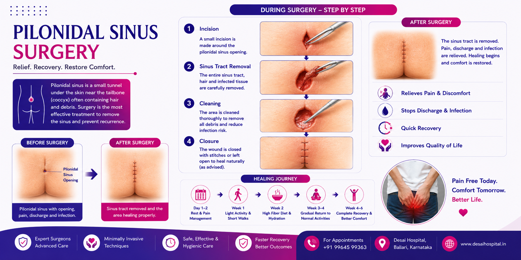 Pilonidal Sinus